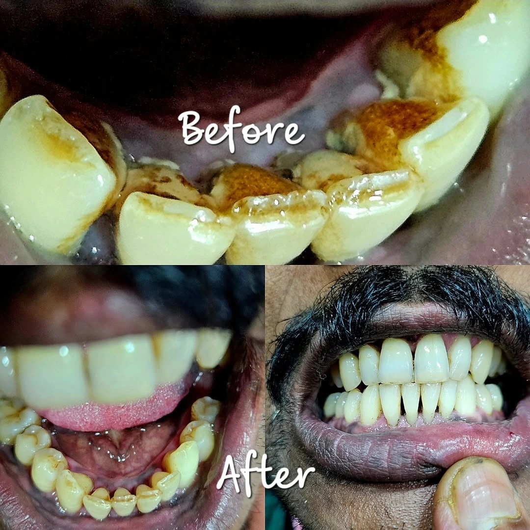 Before and after smile result 19