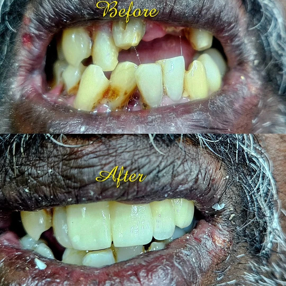 Before and after smile result 20