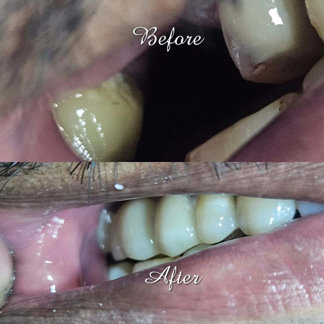Orthodontic Specialist Kodaikanal