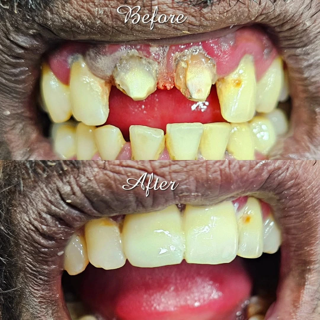 Gum Treatment Specialist Kodaikanal