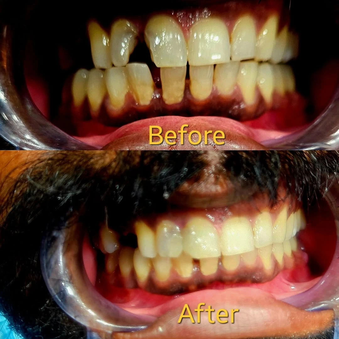Oral Surgery Specialist Kodaikanal