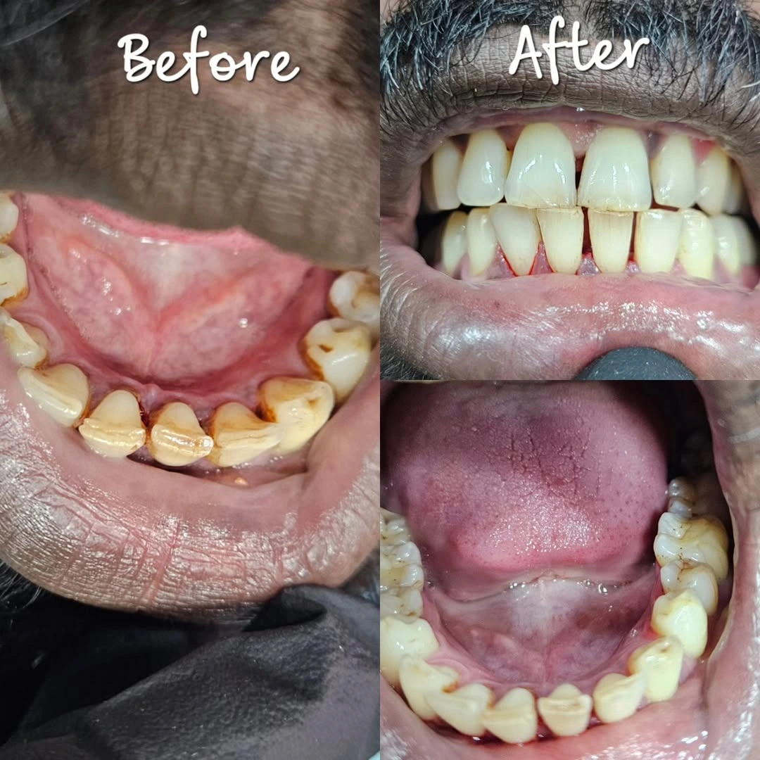Before and after smile result 28