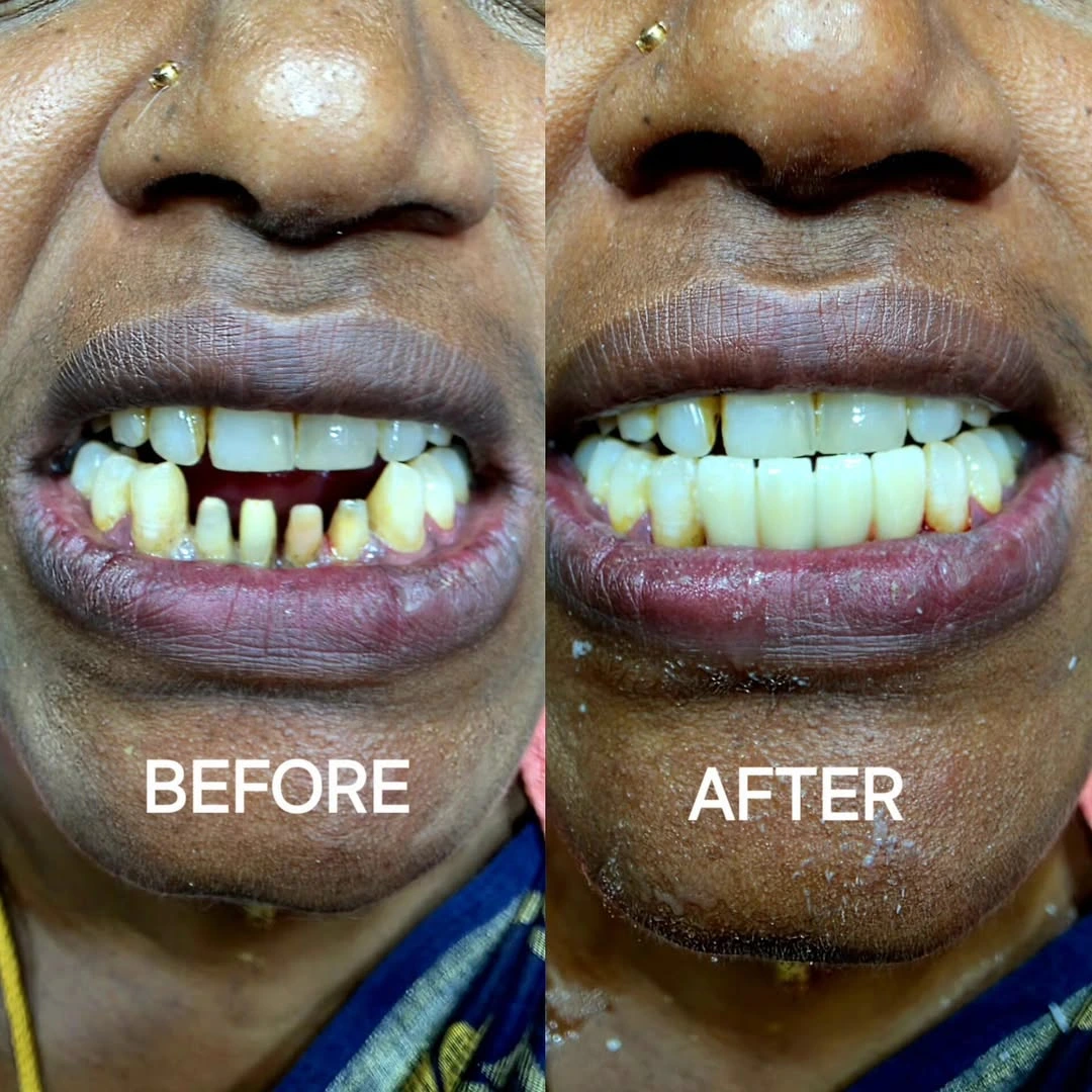 Before and after smile result 31